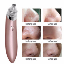 Vacuum Pore Cleaner and Black Head Remover