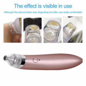 Vacuum Pore Cleaner and Black Head Remover